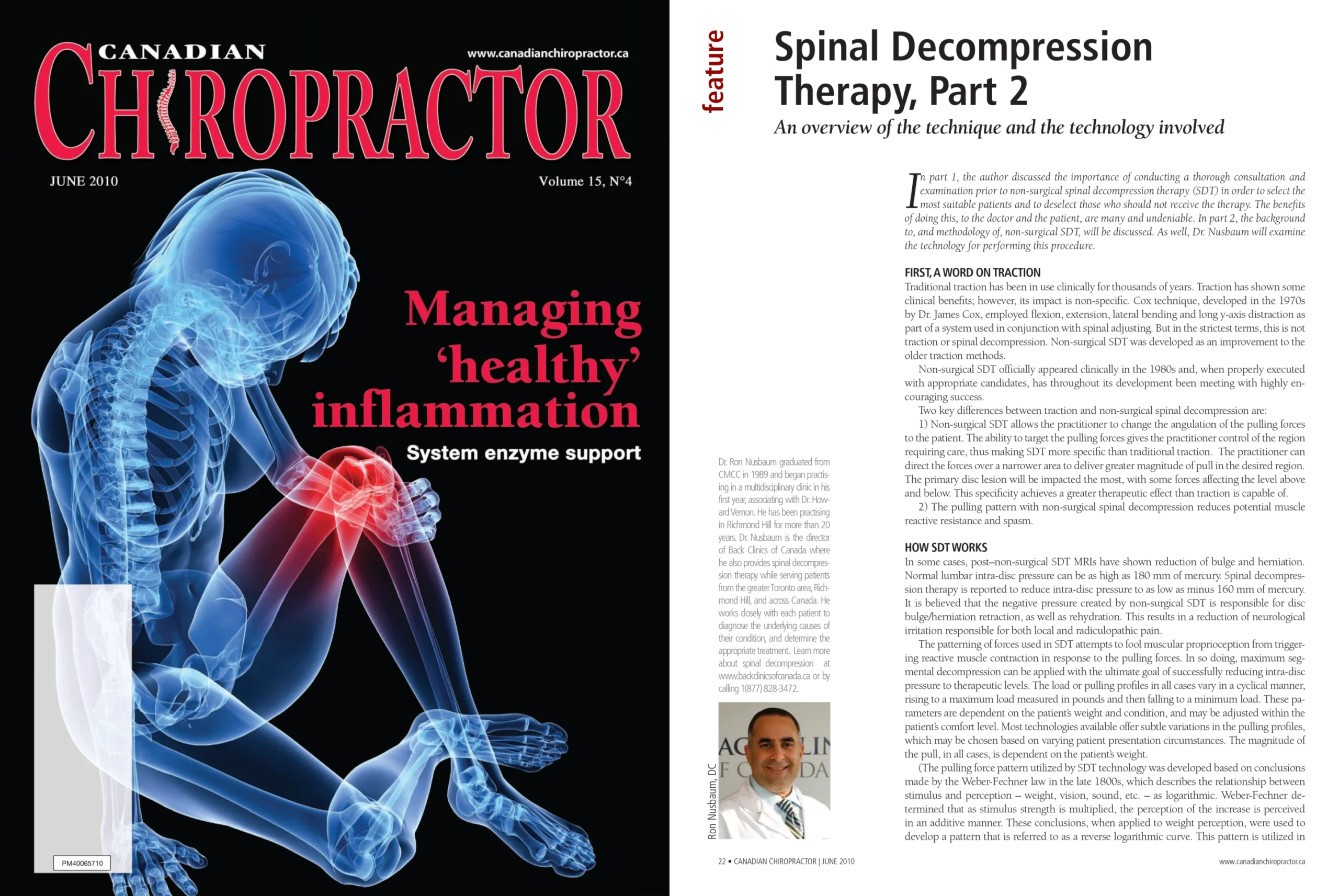 Spinal Decompression Therapy, Part 2