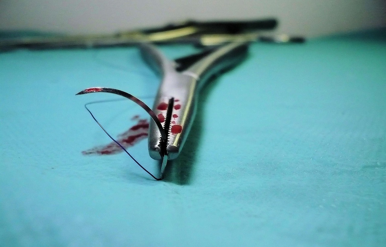 Spinal (Back) Surgery Risks and Complications: Implants and Fusions