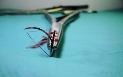 Spinal (Back) Surgery Risks and Complications: Implants and Fusions