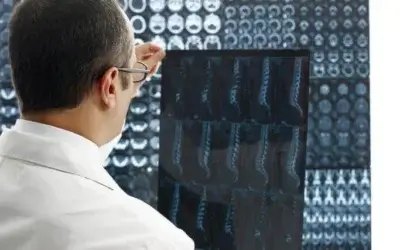 Low Back Pain X-ray Findings