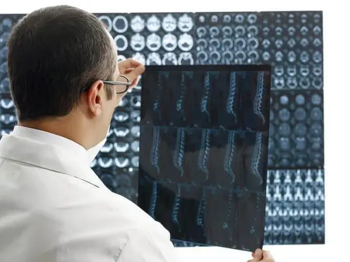 Low Back Pain X-Ray Findings