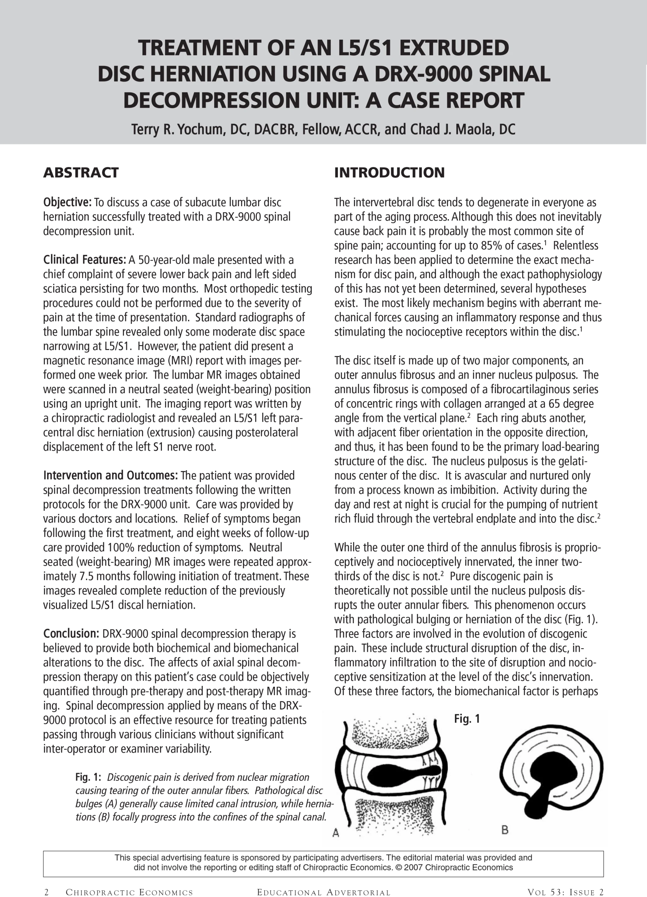 Treatment of an L5 S1