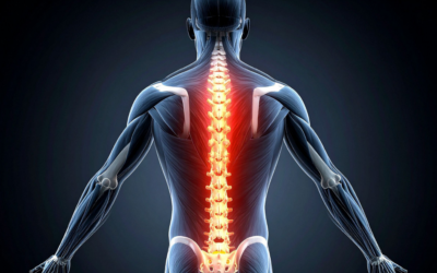 What to Expect From Non-Surgical Spinal Decompression Therapy