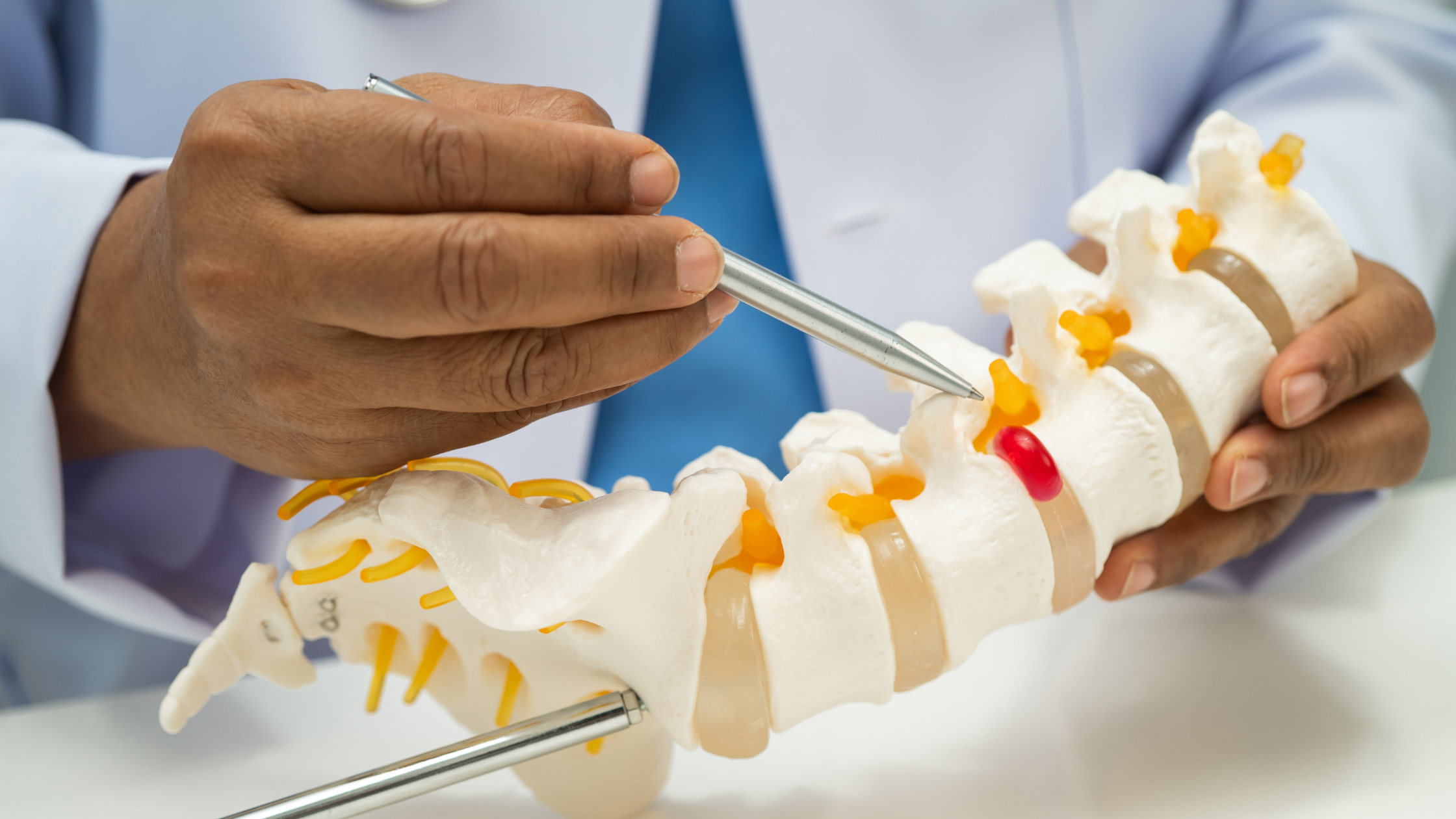 Model of a degenerative spinal disc