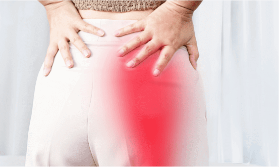 Illustration of sciatica and the sciatic nerve